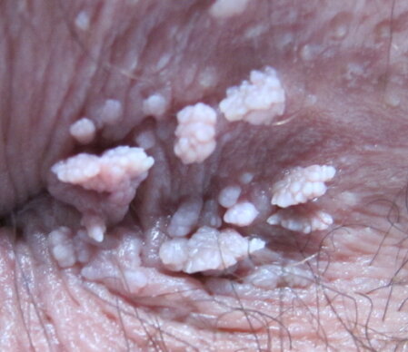 Colloquio rassicurante tra medico e paziente in ambulatorio