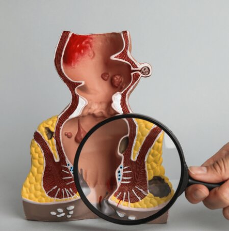 Illustrazione anatomica del plesso emorroidario